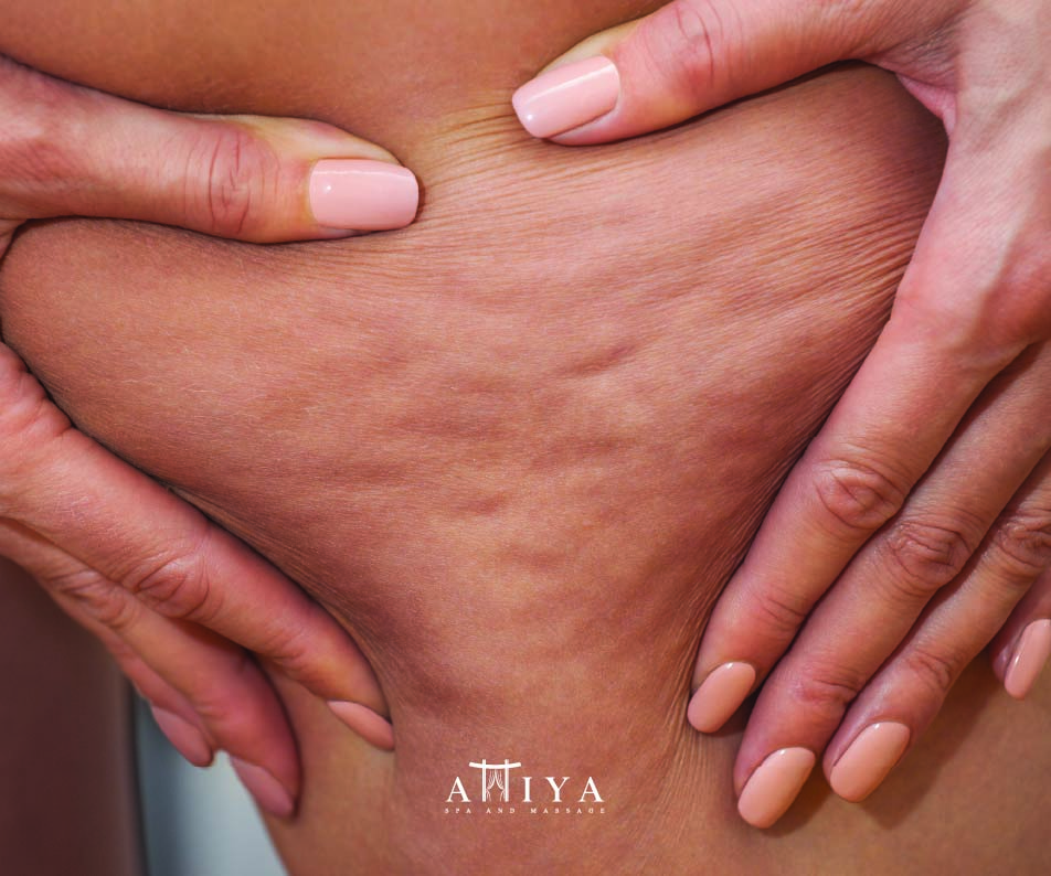 CELLULITE & SLIMMING Image